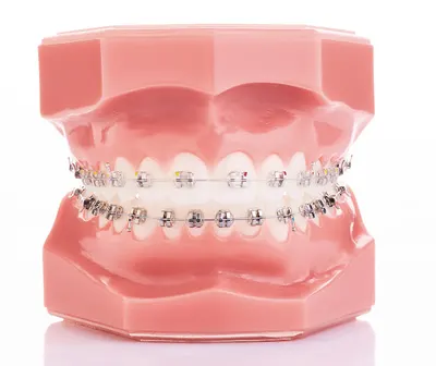 lek. dent. Karolina Chrapla, specjalista ortodonta